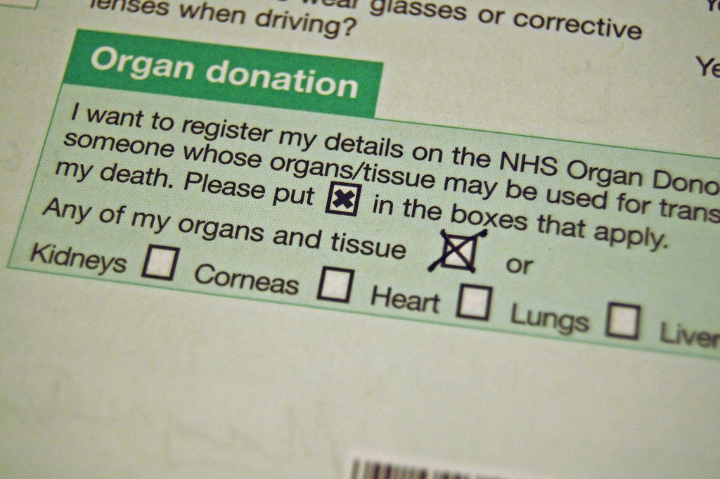 organ donation transplant list nhs register